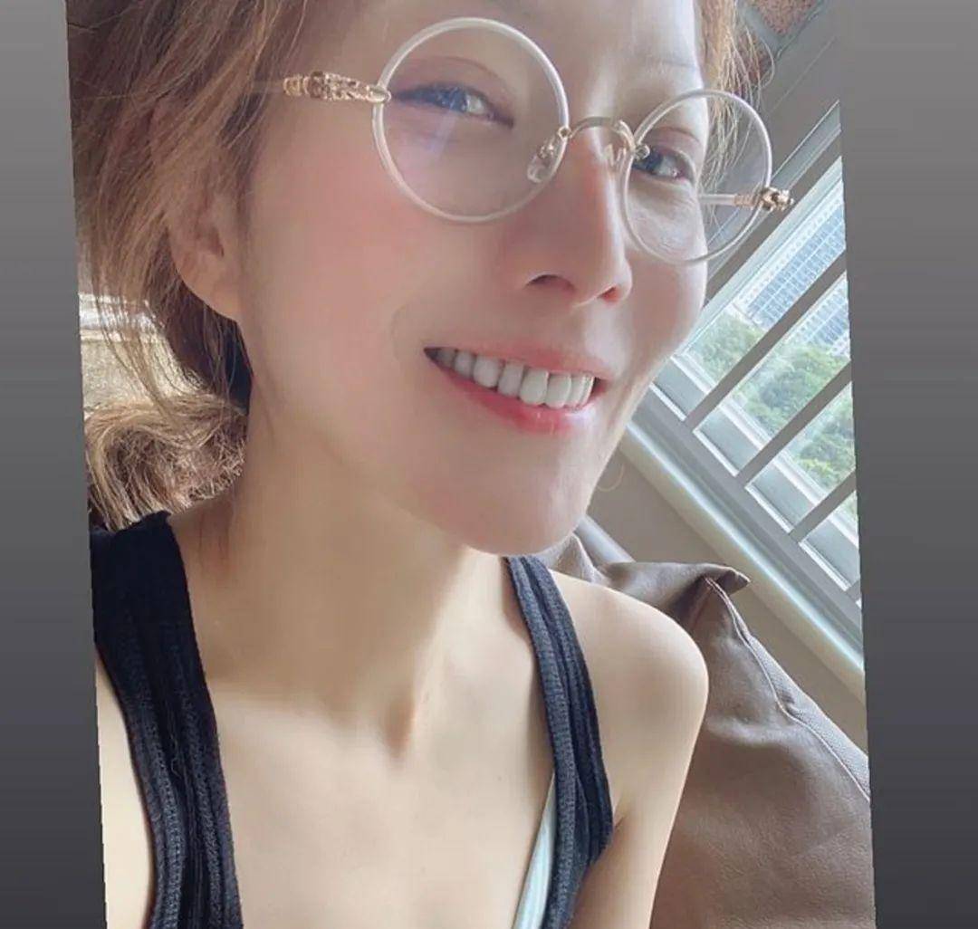 郑秀文晒刮痧照片