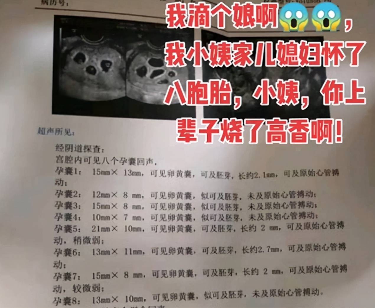 18岁女子怀八胞胎