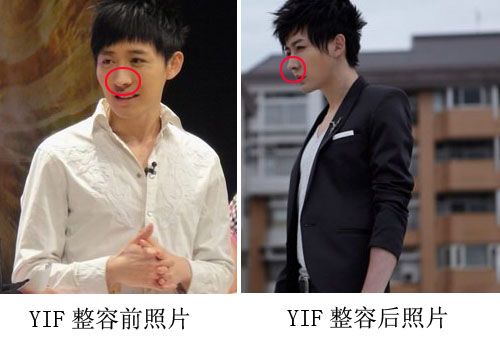 yif穿帮
