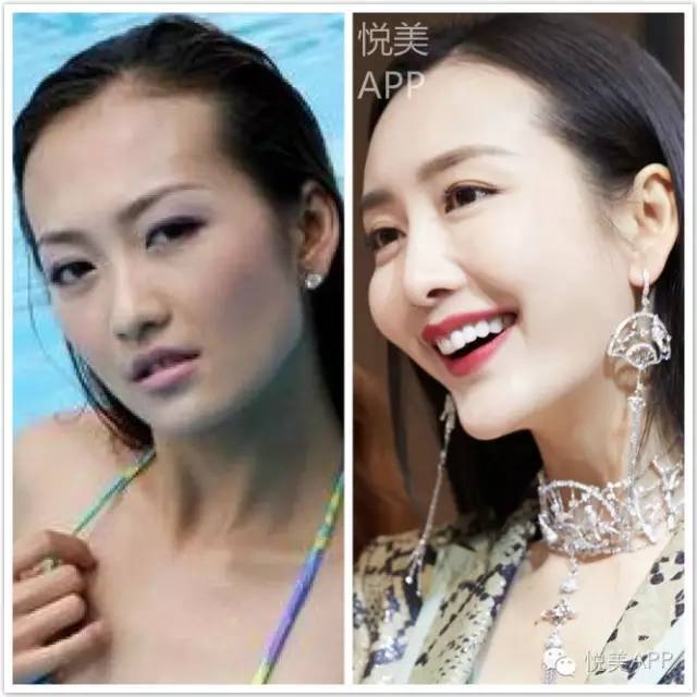 王鸥整容
