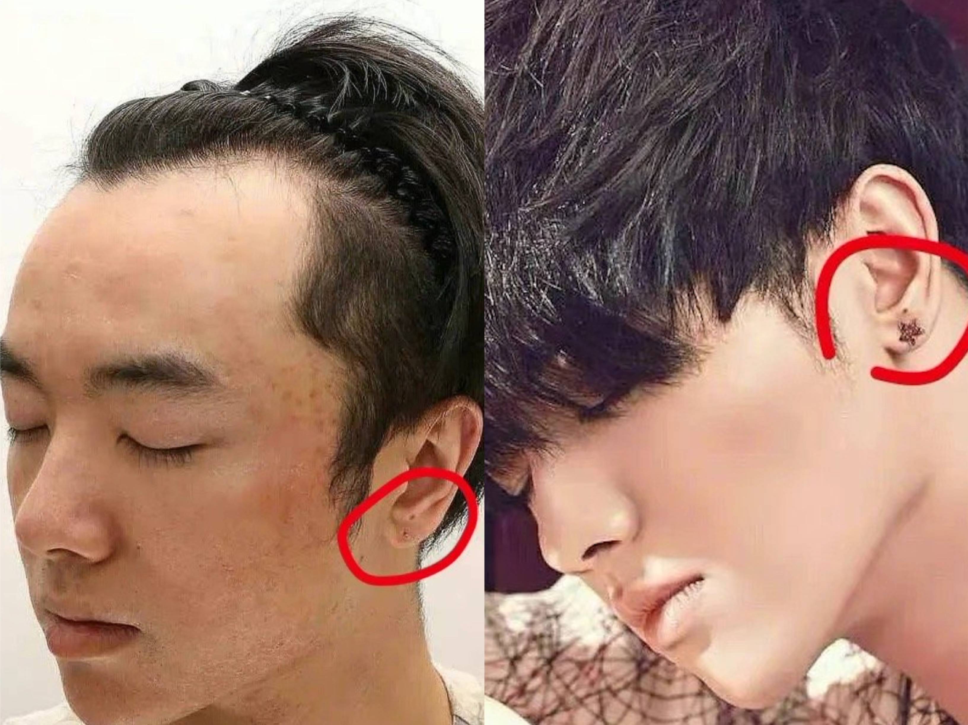 曝华晨宇整容植发的简单介绍