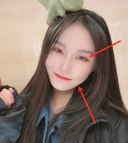 杨馥宇整容