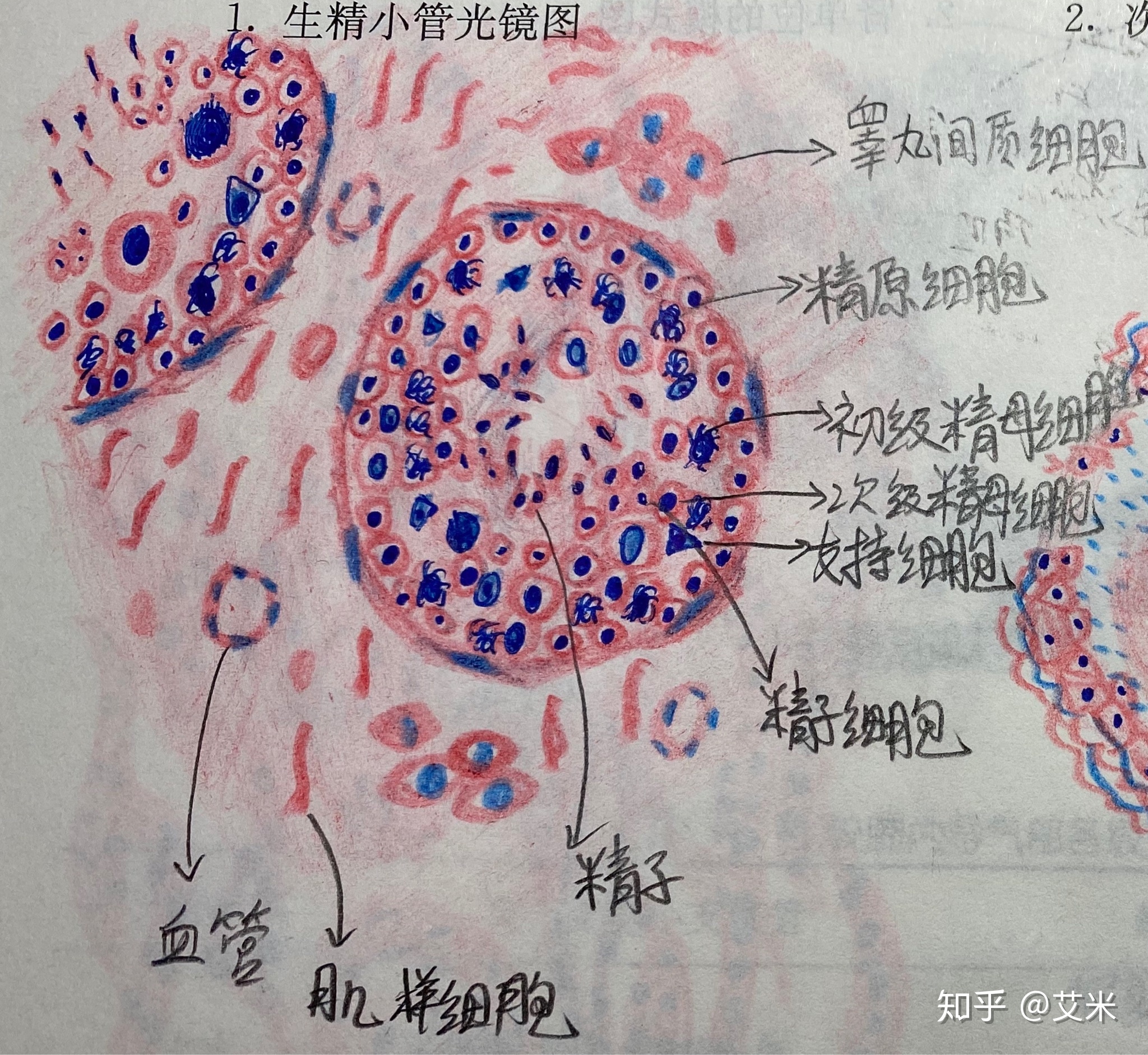 艾米的验尸呈报