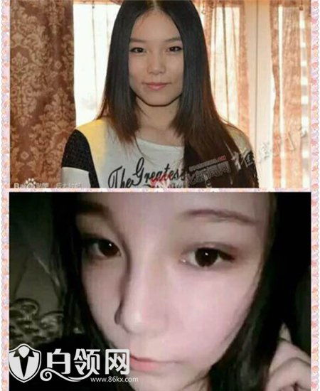 本兮怎么了