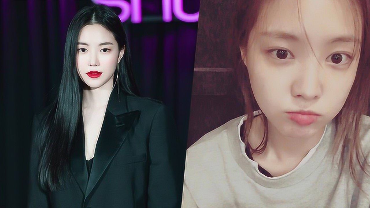 孙娜恩整容