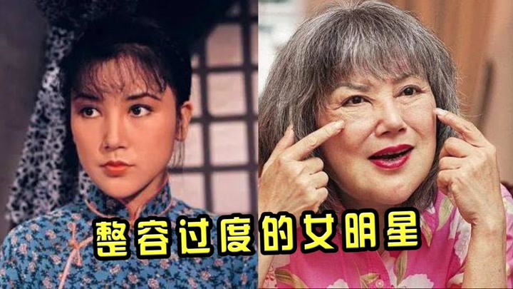 邵音音整容失败