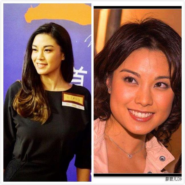 廖碧儿整容 廖碧儿整容