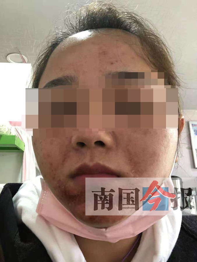 毁容门
