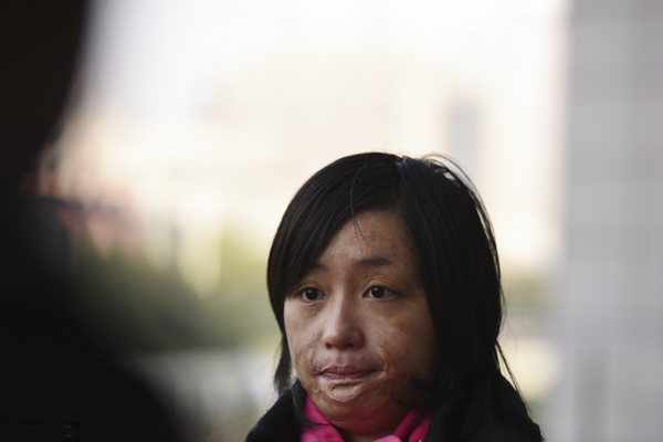 毁容门 毁容门