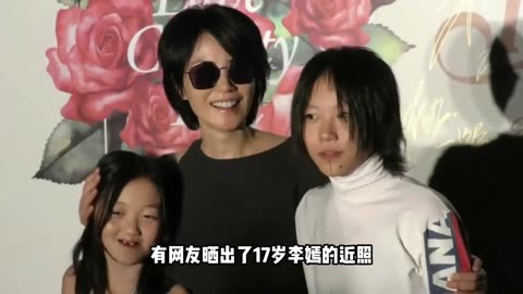 李嫣唇腭裂修复对比图