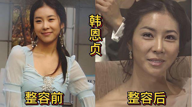 刘仁娜整容前 刘仁娜整容前后照片 
