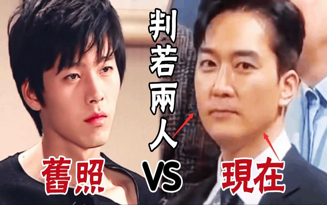 宋承宪整容前照片 宋承宪颜值巅峰 