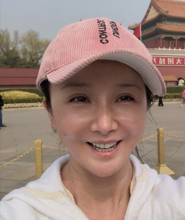孙菲菲整容前 孙菲菲整过容吗 孙菲菲整容前 孙菲菲整过容吗