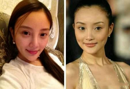 李小璐整容失败 李小璐整容失败图片