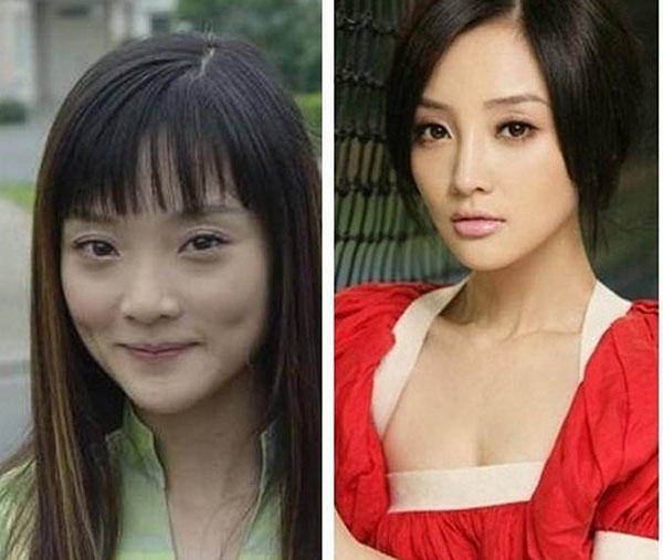 李小璐整容掉败 李小璐整容掉败图片 