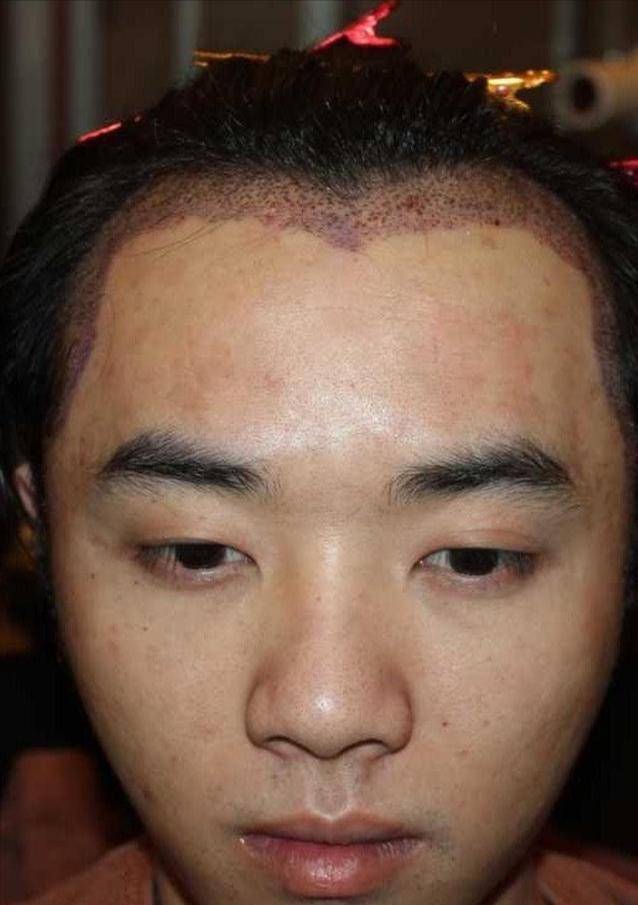 爆料华晨宇整容植发者公开道歉 华晨宇真的植发了吗
