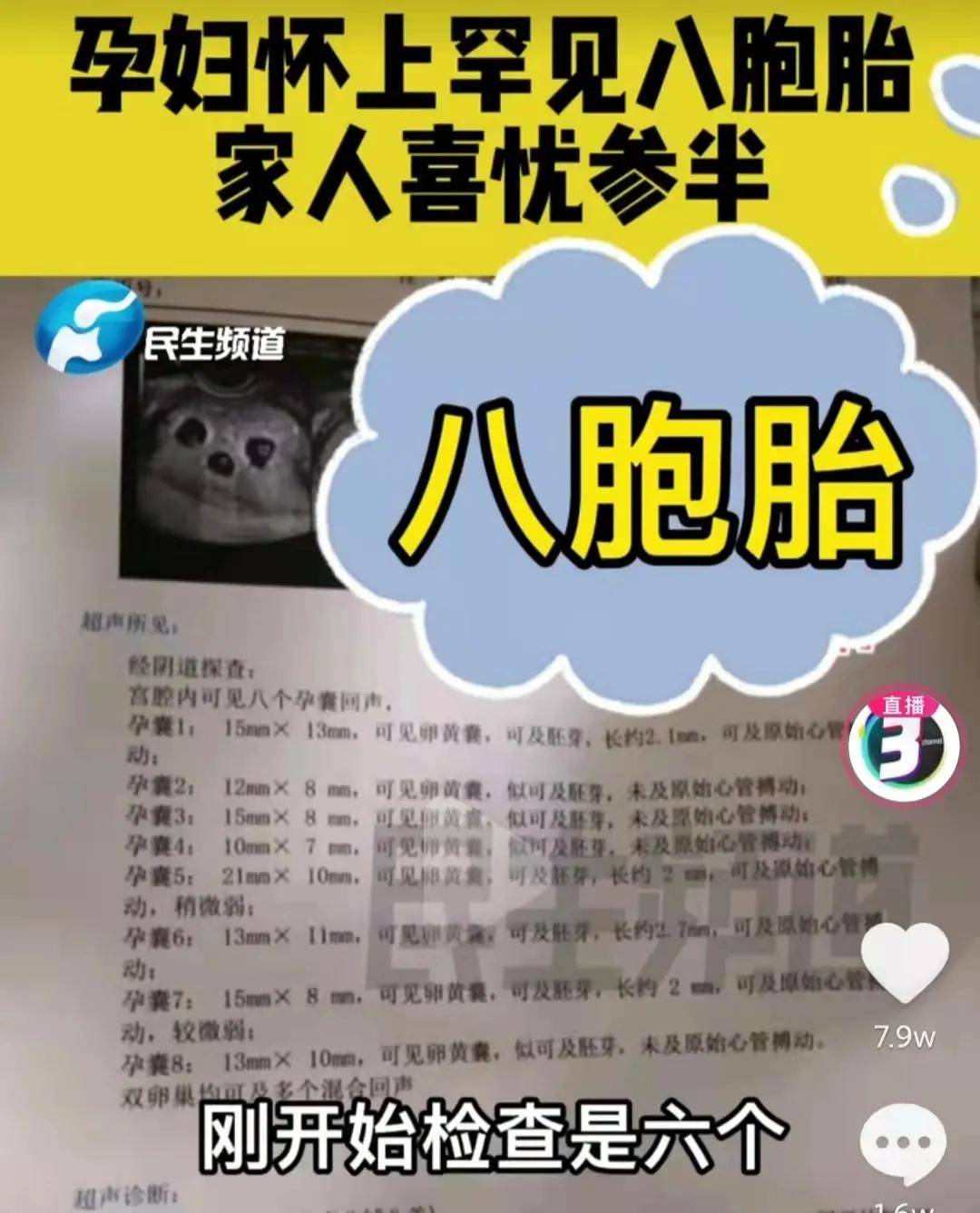 郑州怀八胞胎女子仅18岁 郑州怀八胞胎女子仅18岁以上 