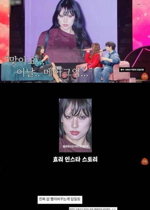 李孝利整容 李孝利整容后遗症 李孝利整容 李孝利整容后遗症