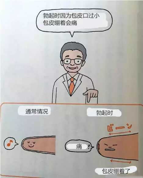 男明星割包皮 男明星割包皮有几团体 男明星割包皮 男明星割包皮有几团体