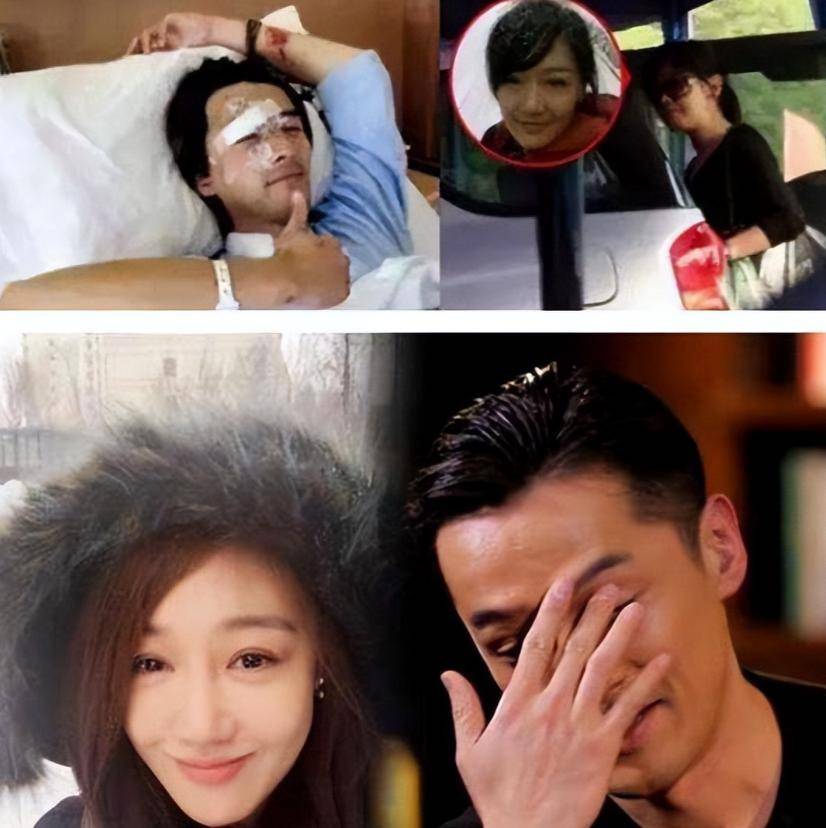 胡歌车祸前后对比图 胡歌车祸前后对比图片 