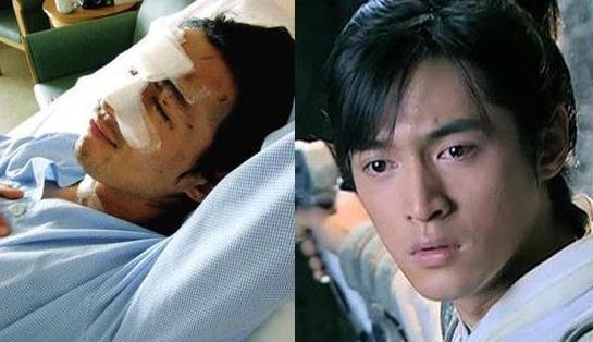 胡歌车祸前后比照图 胡歌车祸前后比照图片 胡歌车祸前后比照图 胡歌车祸前后比照图片
