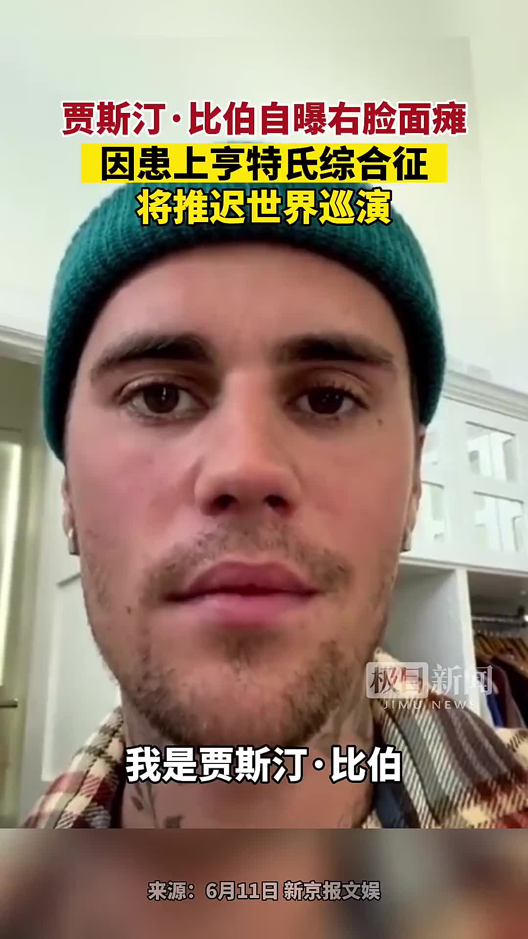 比伯患亨特氏综合征 亨伯特·亨伯特式人物