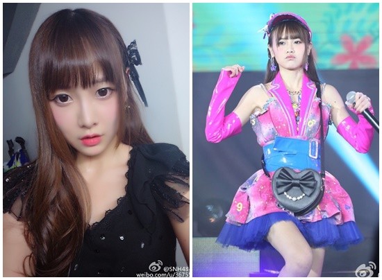 唐安琪烧伤事件 唐安琪烧伤照片 