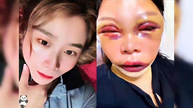 韩国整容掉败的明星 韩国整容掉败的明星有哪些 韩国整容掉败的明星 韩国整容掉败的明星有哪些