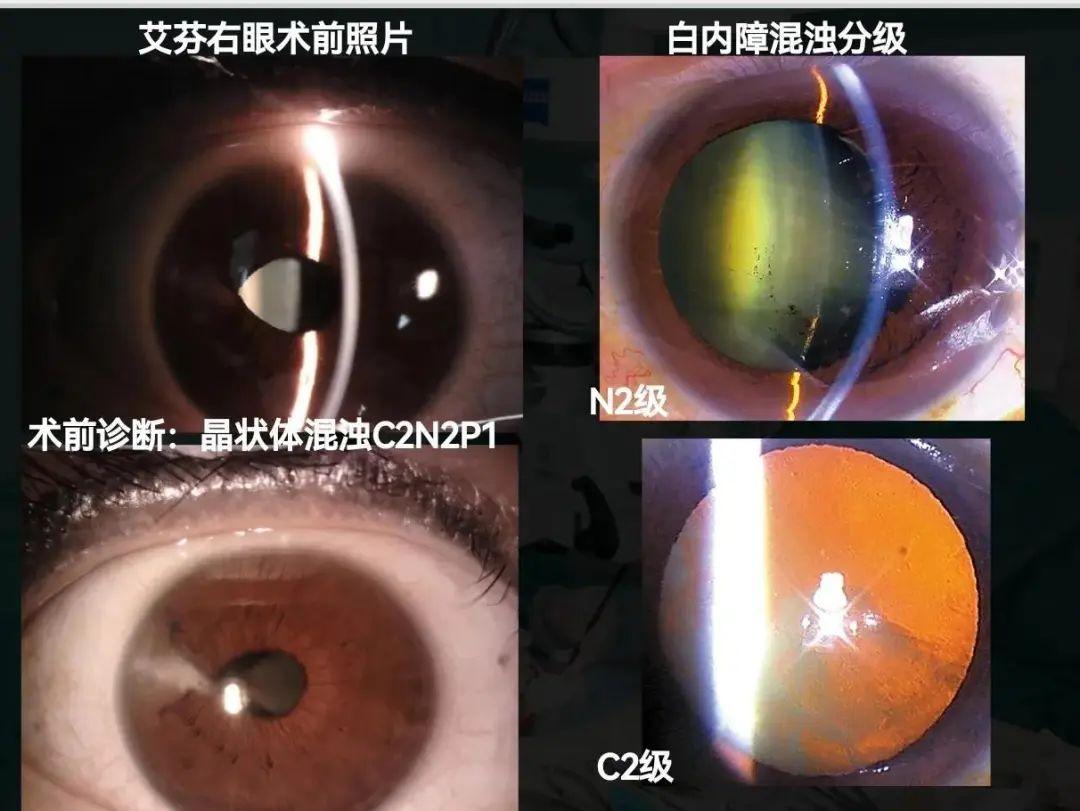 横内晶 横内晶和 王菲什么干系 横内晶 横内晶和 王菲什么干系