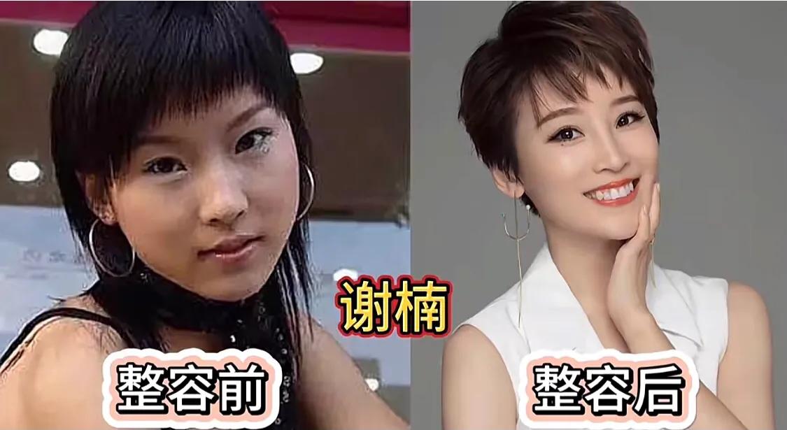 超等女声整容的复杂引见 超等女声整容的复杂引见